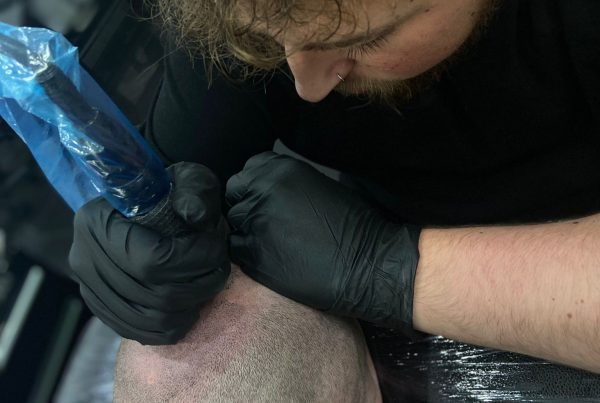 Scalp Micropigmentation